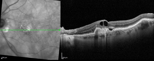 oculista gardone val trompia